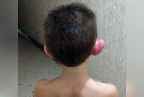 Filho chegou com a orelha inchada  Áudios Engraçados do Zap