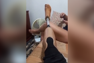 Baixar video Eu tenho cosca, cuidado